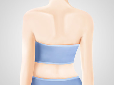 瘦颈瘦背局部减肥纤体方案